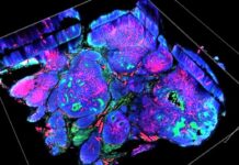 Battery’s Oxygen Deprivation: A Potential Revolution in Cancer Therapy