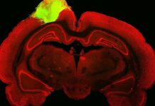 Groundbreaking Study Reveals Transplanted Human Brain Organoids Can Respond to Visual Stimuli in Rat Brains