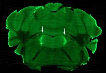 Hormone FGF21 Induced by Alcohol Consumption Accelerates Recovery of Drunk Mice by Activating Noradrenergic Neurons Responsible for Arousal and Alertness