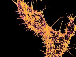 Unlocking the Enigma: Unraveling the Impact of TAOK1 Mutations on Membrane Dynamics