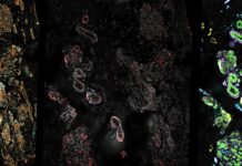 Unlocking the Mystery: Androgens’ Influence on Breast Tissue Revealed in Transgender Men’s Hormone Therapy