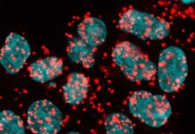Untangling the Role of Mutated Cohesin in Cancer Progression through Alternative Splicing Dysregulation